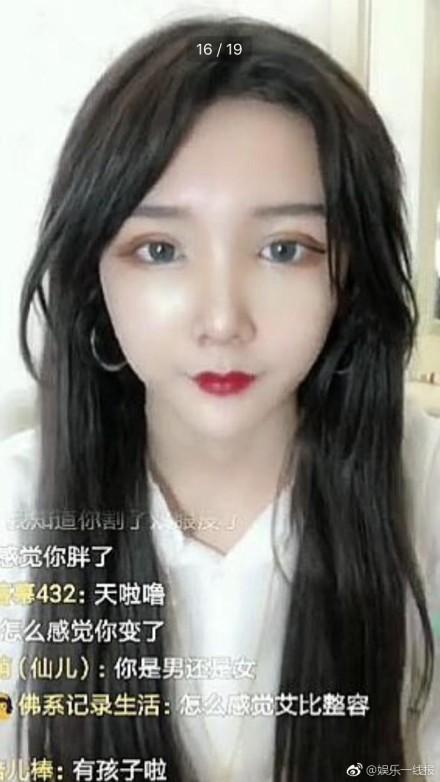 网红嘉欣整容爆料视频播放,网红整形风波视频播放量激增  第3张